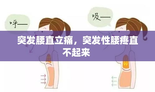 突发腰直立痛,突发性腰疼直不起来